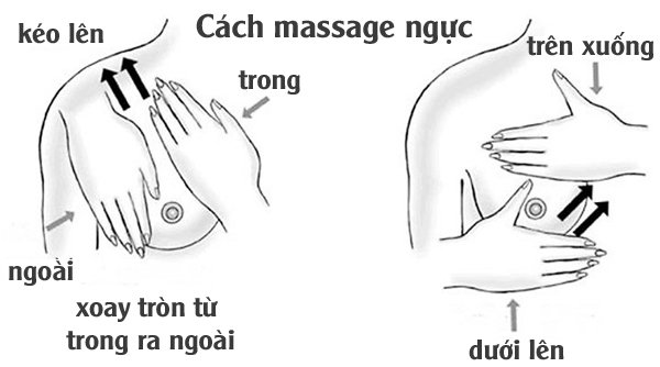 Dấu hiệu áp xe tuyến vú trên siêu âm