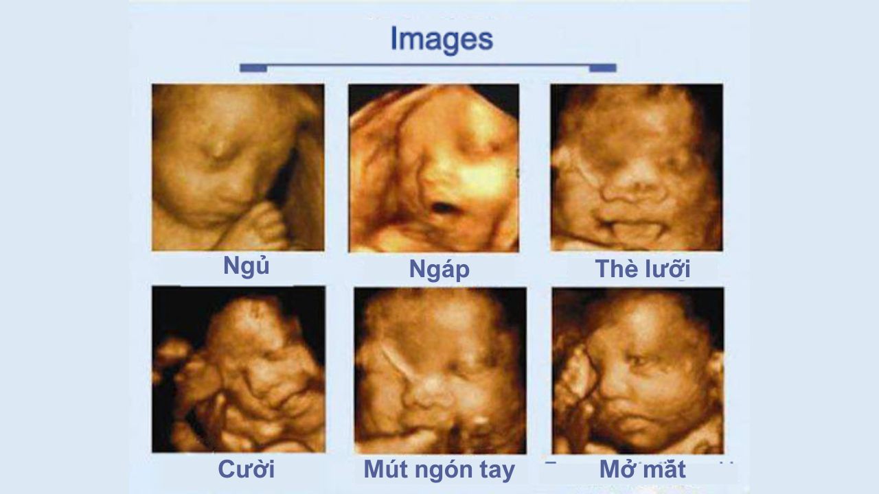 Siêu âm hình thái học thai nhi ở tuần thứ 12 là tốt nhất